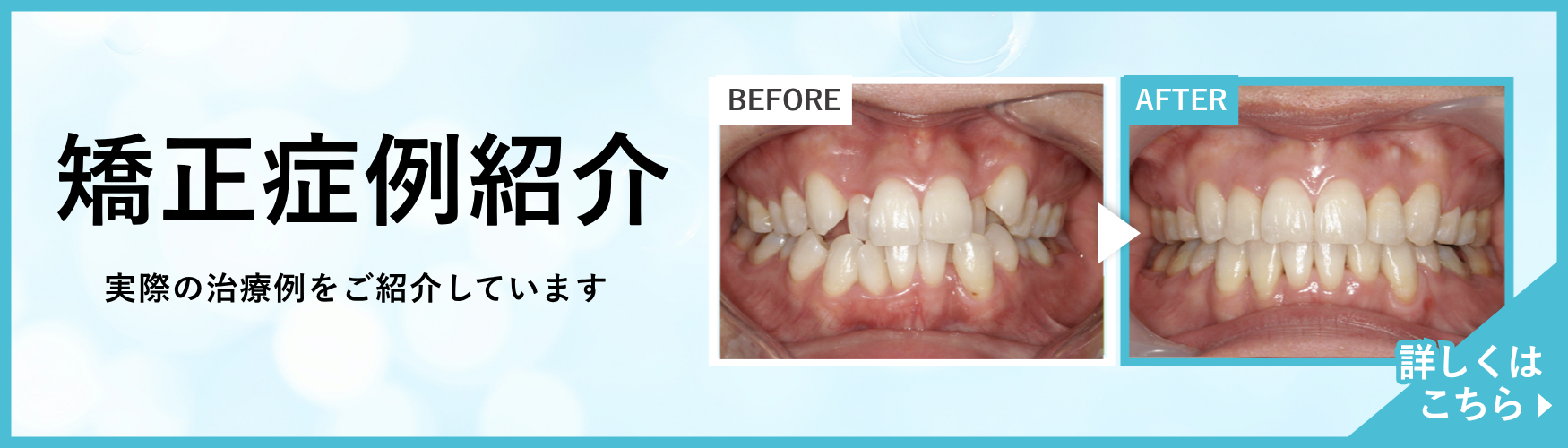 矯正歯科バナー
