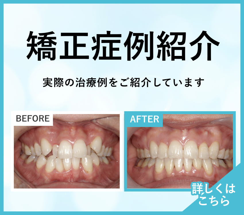 矯正歯科バナー
