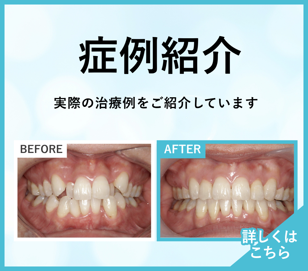 矯正歯科バナー